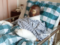 忽然爆炸！！浙江一男子被严重烧伤！！这习惯，，好多人都有